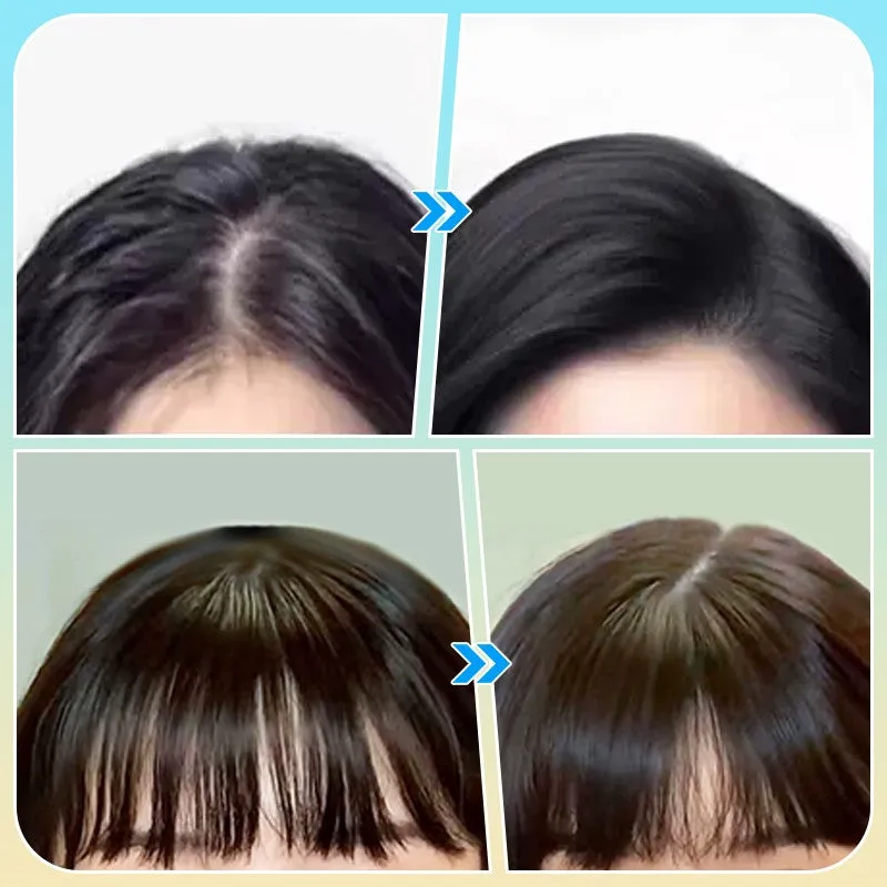 🎅Christmas Hot Sale🎄No Rinse Oil Control Shampoo