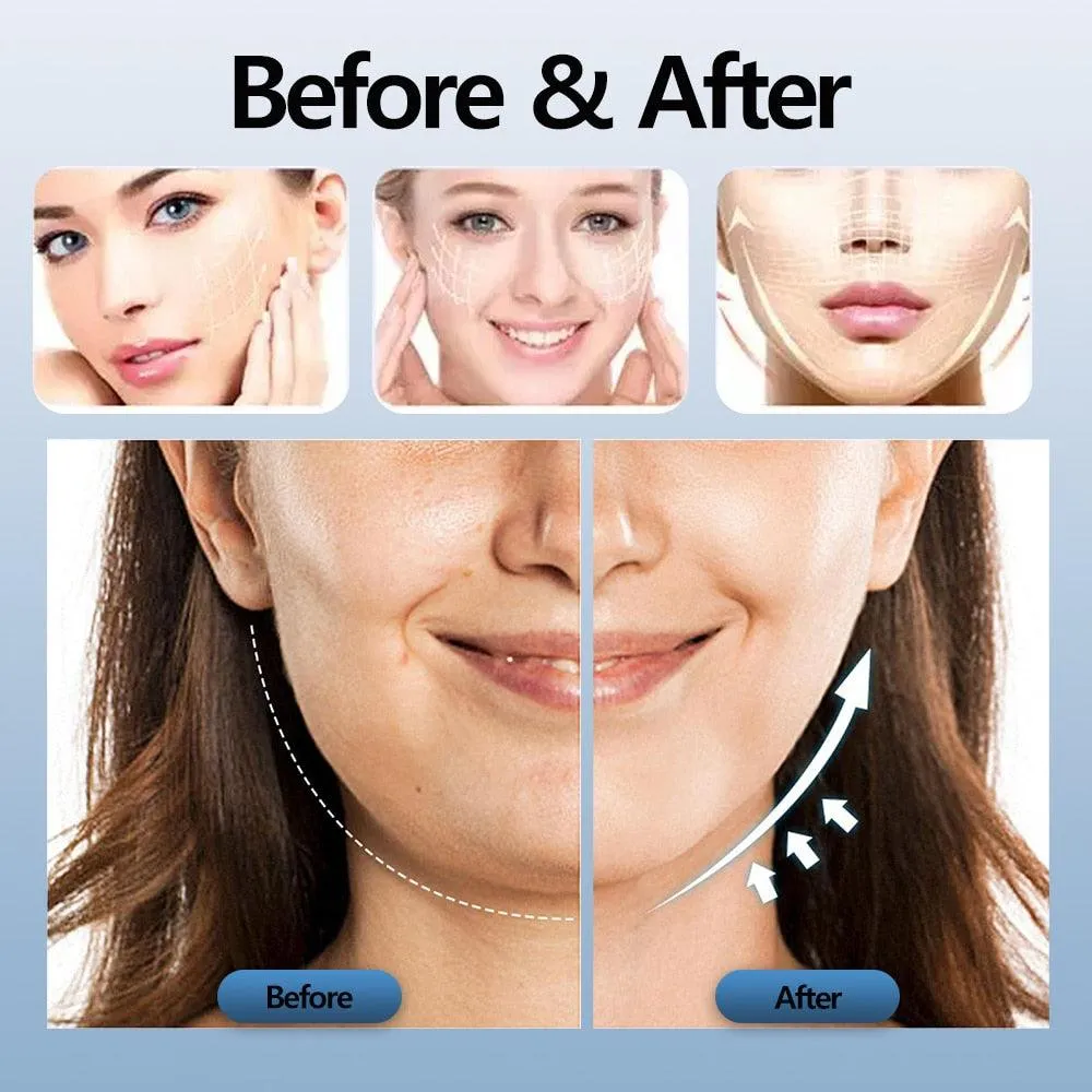 V-Face Beauty Device