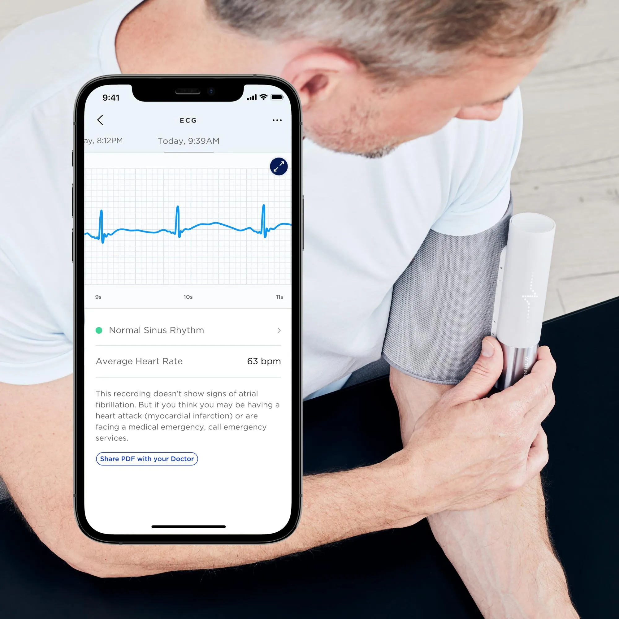 Withings BPM CoreWireless Blood Pressure Monitor